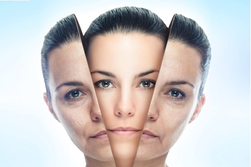 Skin Rejuvenation