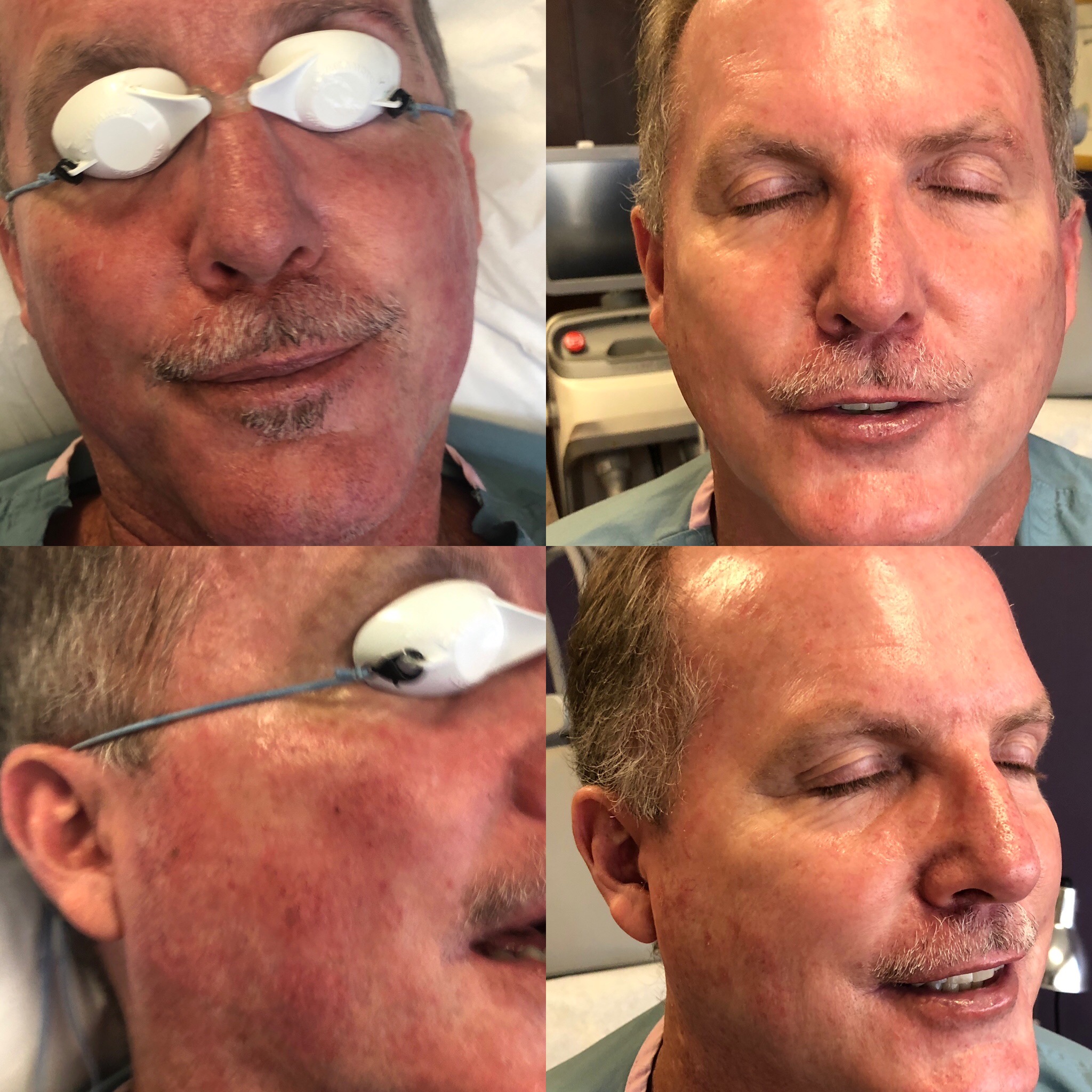 Skin Care San Diego